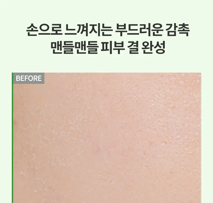 [저자극 필링] 바닐라코 클린잇제로 티트리 포어 필링 젤 120ml (+50ml) 상세페이지 12